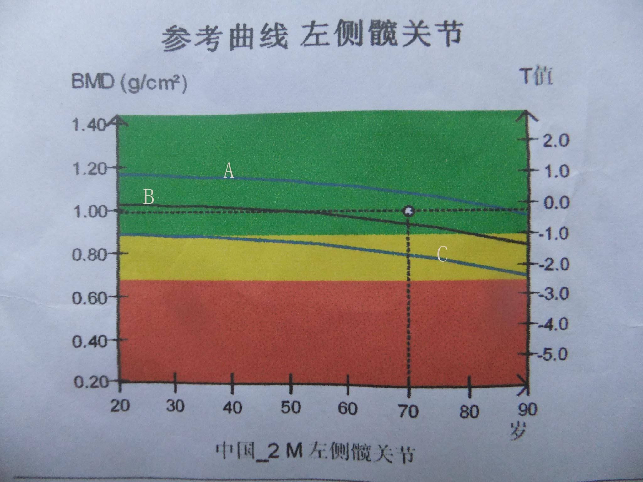 骨密度正常值对照图图片