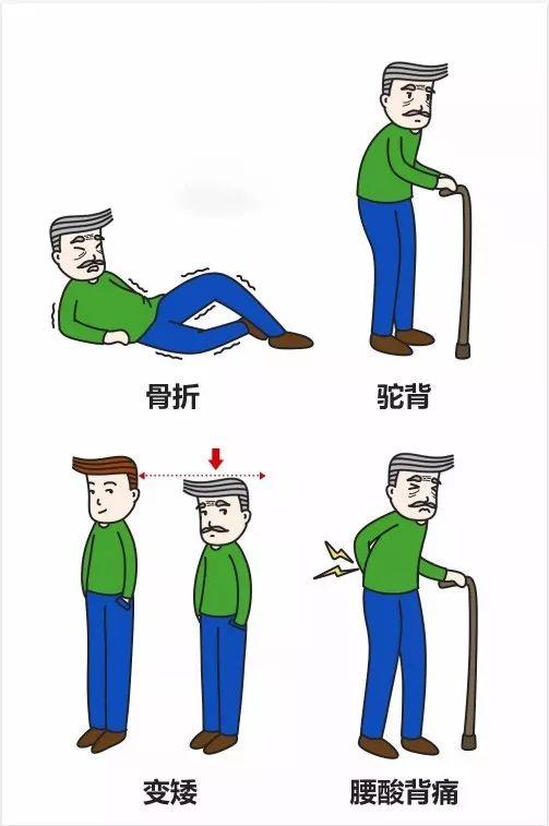 超声骨密度仪检测 超声骨密度仪检测