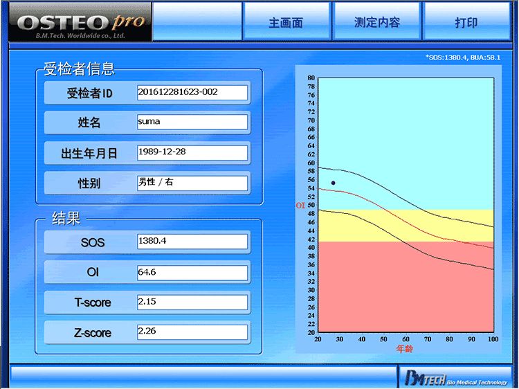 超声骨密度仪