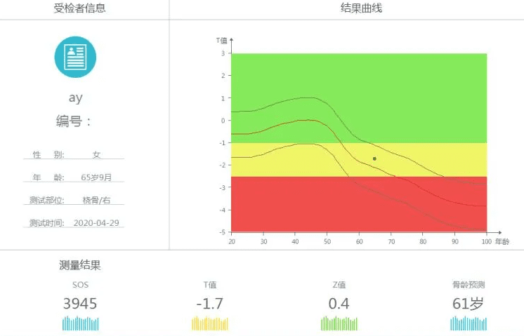 骨密度检测仪器