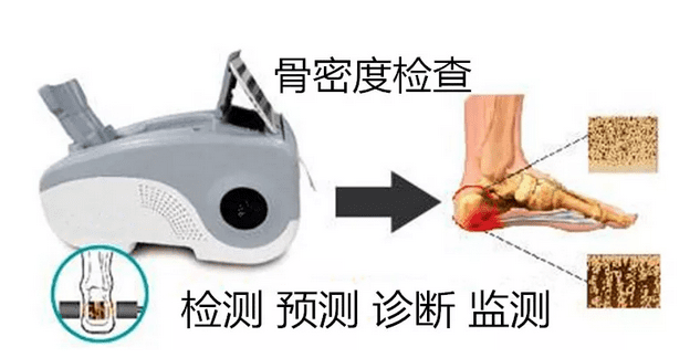 南京科进超声骨密度仪